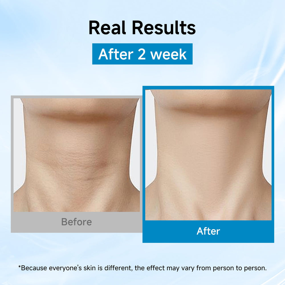 HONLINK hydration with hyaluronic acid and glycerin