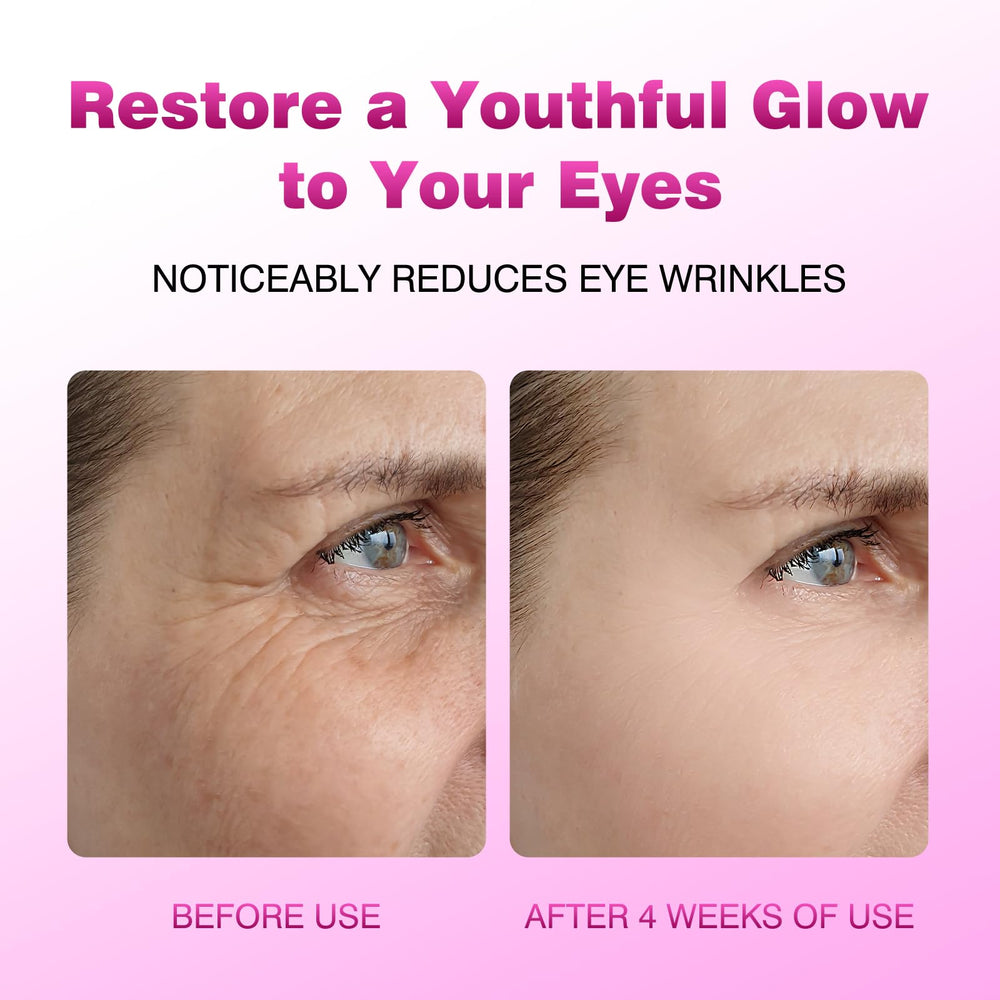 Caffeine brightening effect of HORLLM eye cream balm under-eye area