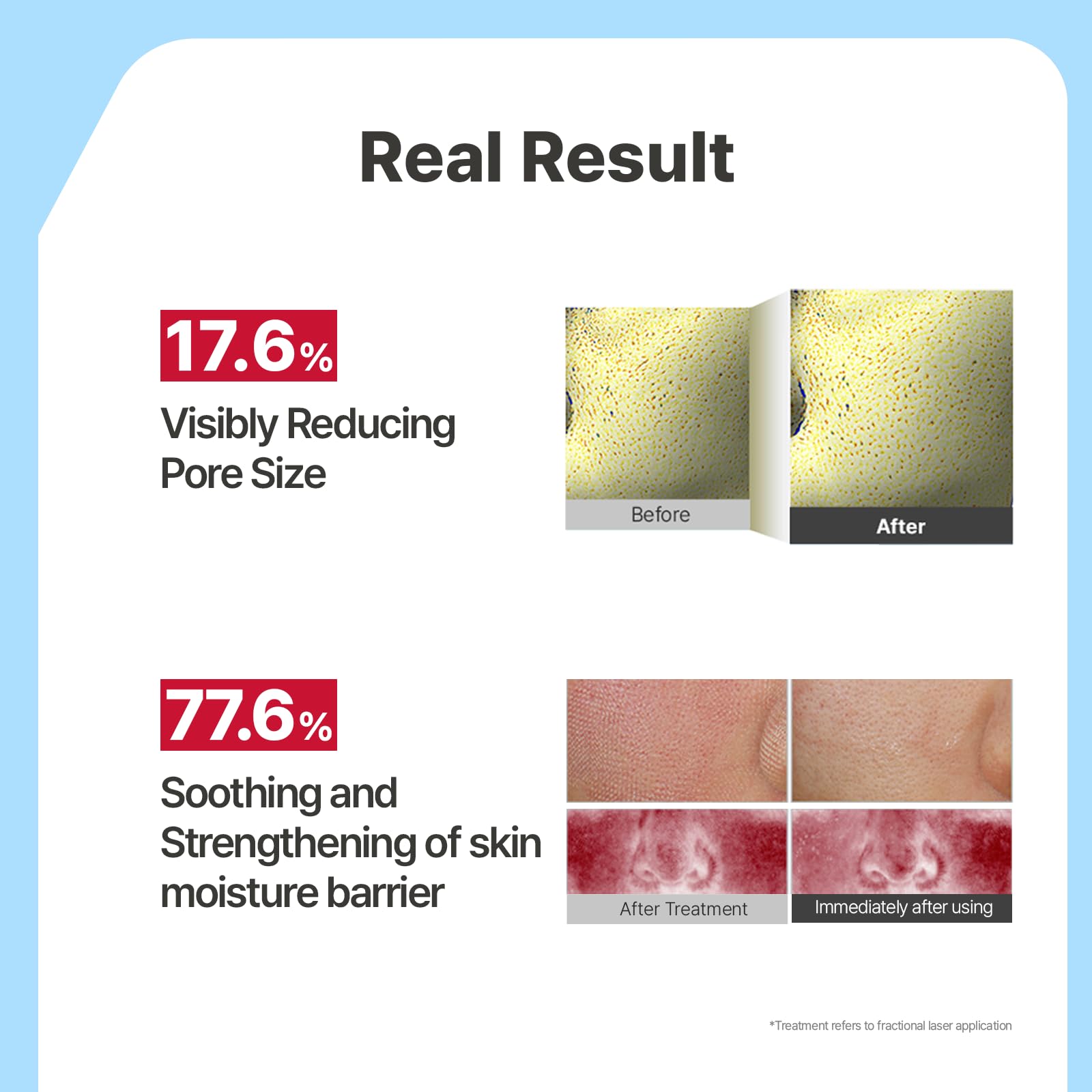 Illiyoon Ceramide Ato mask overnight hydration scene on skin