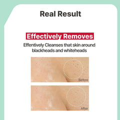 Coconut oil pore cleansing detail highlights impurity removal.