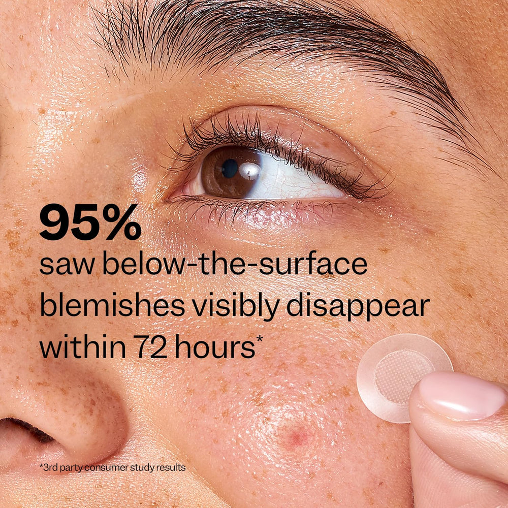 Peach Slices skincare routine shot showing cleanse before applying patches.