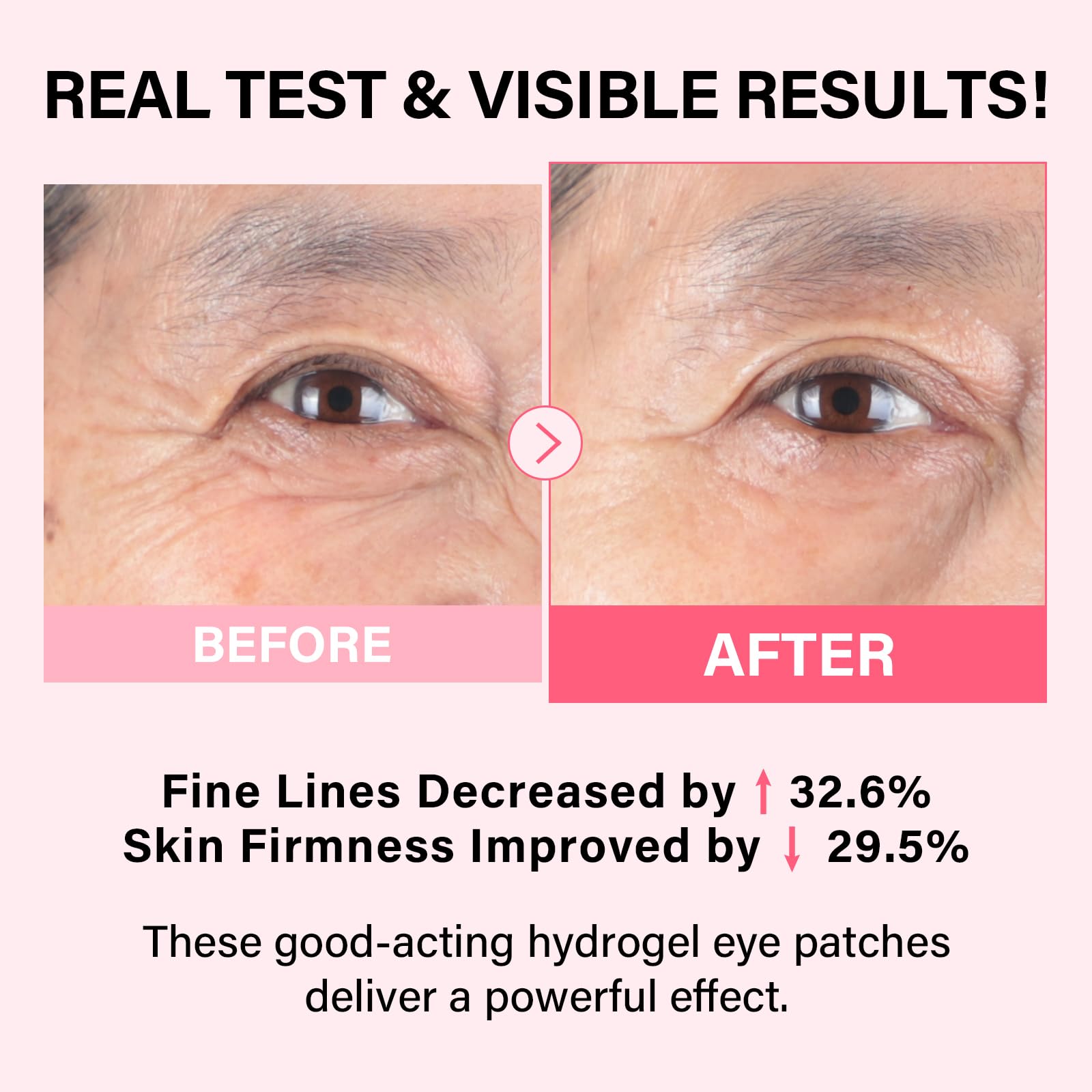 iMethod PDRN eye patch with cooling gel soothing under-eye area