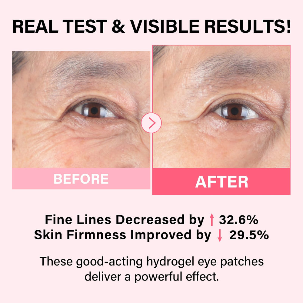 iMethod PDRN eye patch with cooling gel soothing under-eye area
