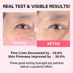iMethod PDRN eye patch with cooling gel soothing under-eye area