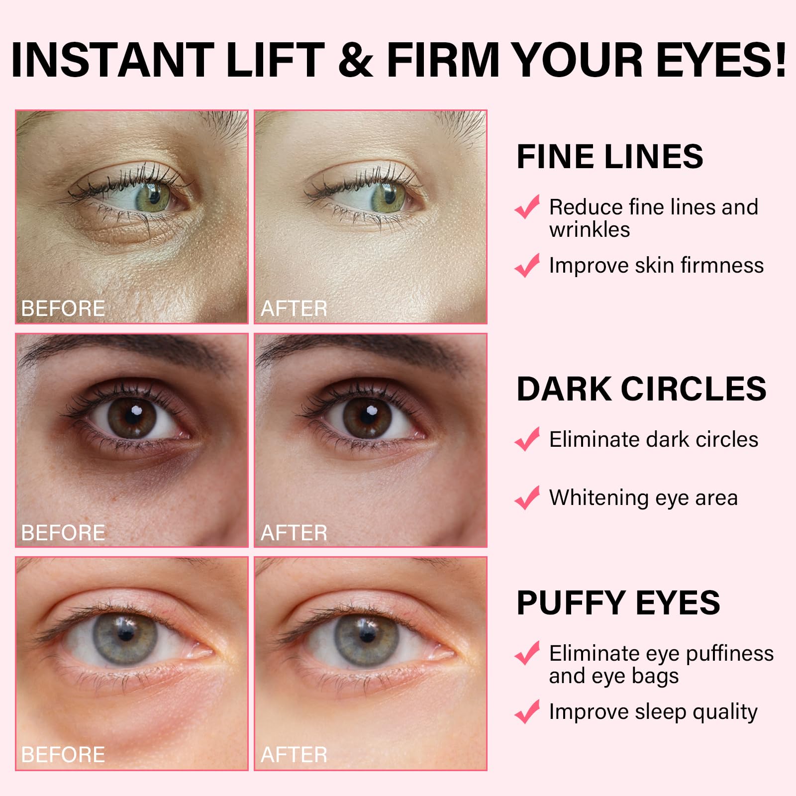 iMethod PDRN eye patch reducing dark circles under eyes