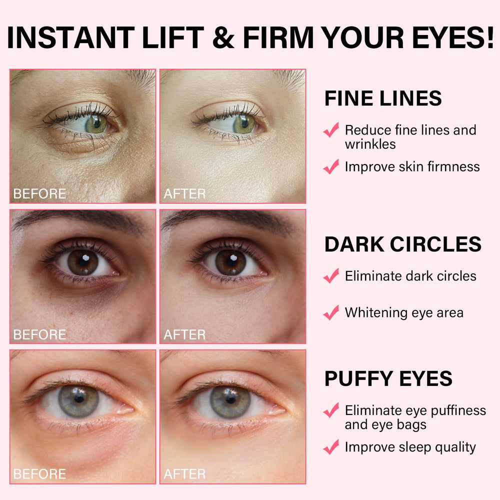 iMethod PDRN eye patch reducing dark circles under eyes
