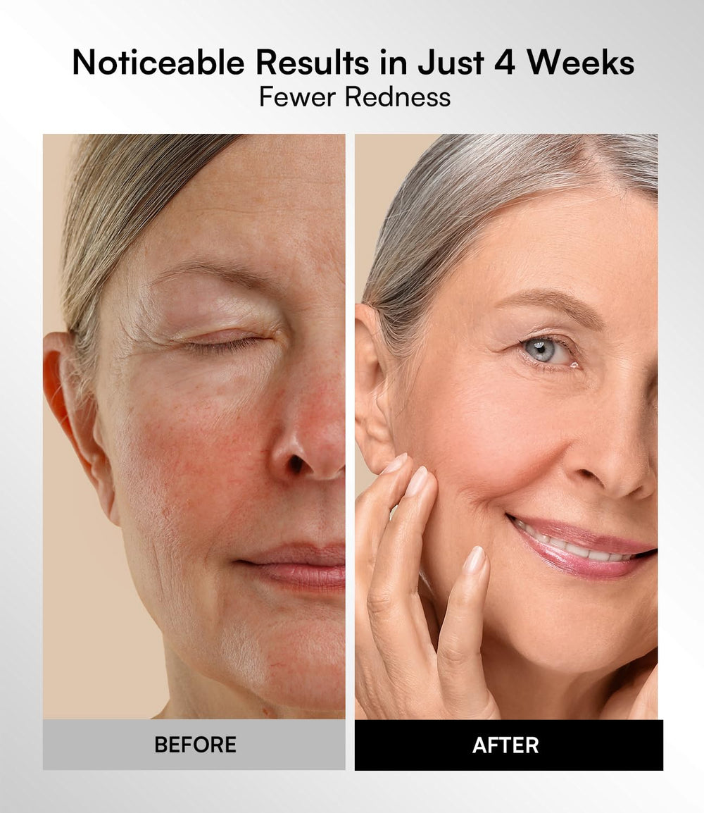 NIR activation shows deep-penetrating light option on INIA mask.