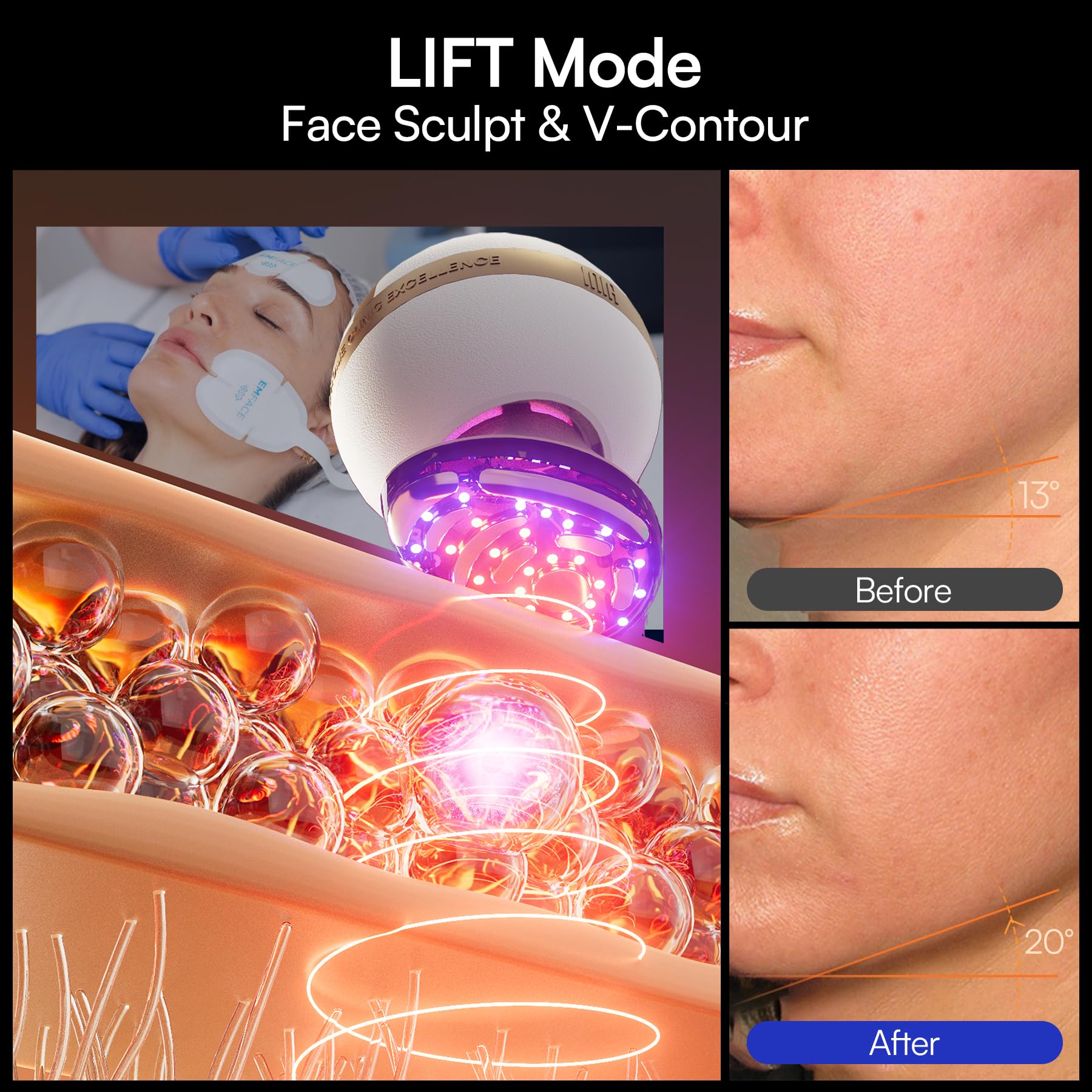 INIA SPHERA cooling therapy cools skin for quick de-puff.