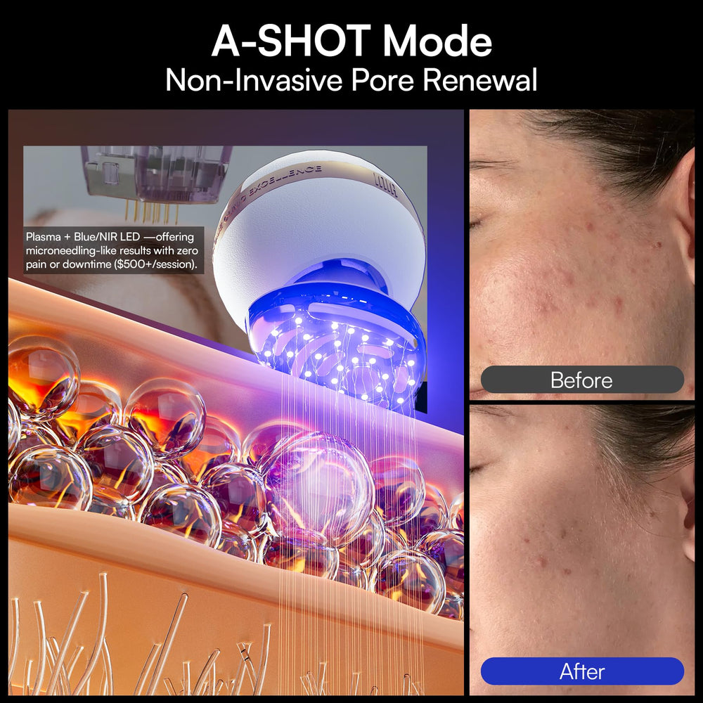 INIA SPHERA electroporation infusion boosts treatment effectiveness with serums.