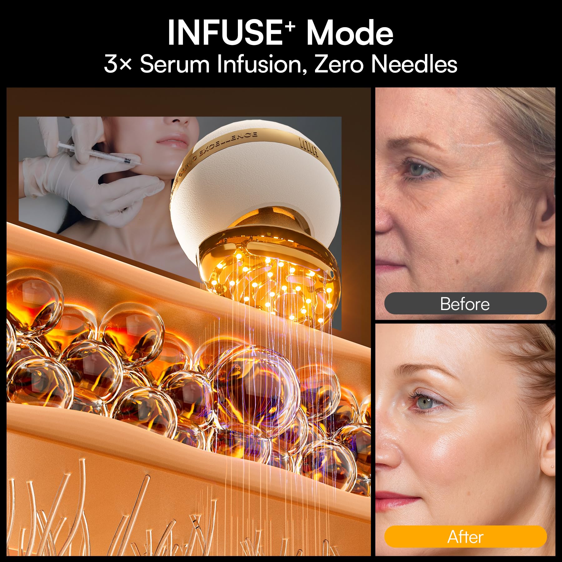 INIA SPHERA microcurrent lift delivers gentle facial toning.