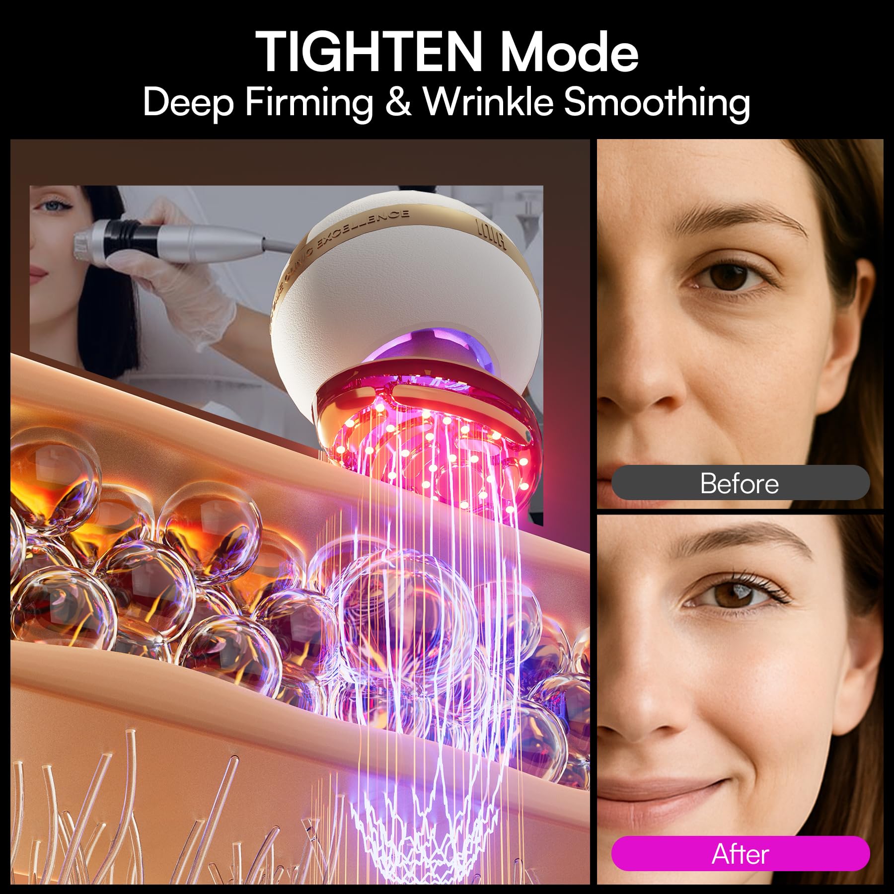 INIA SPHERA red LED light promotes radiant skin at home.