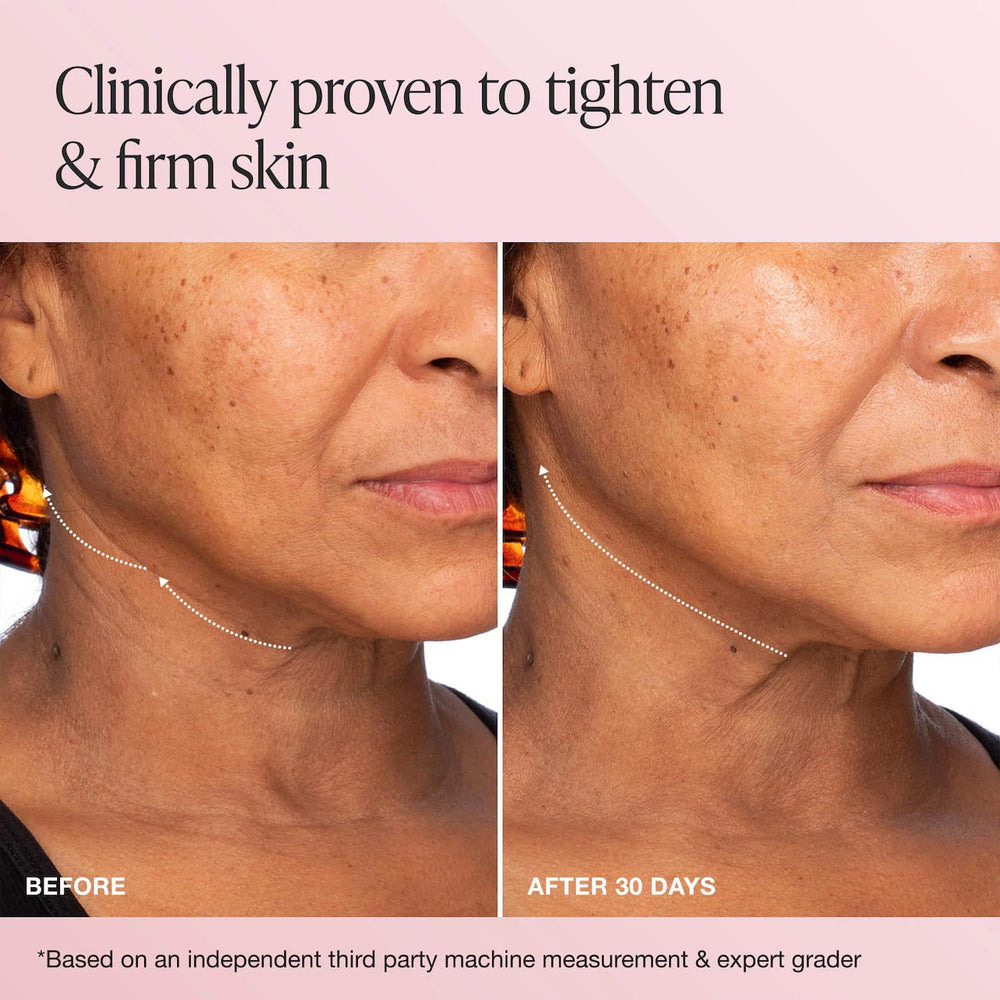 Innbeauty Project Extreme Cream packaging highlighted for a refined skincare routine