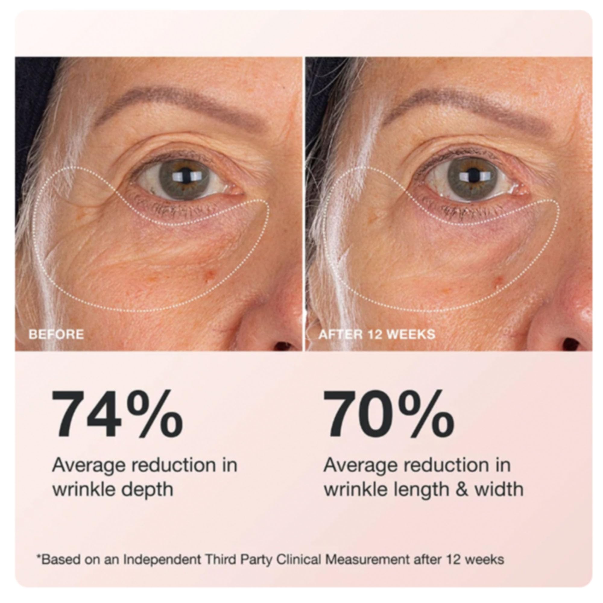 Innbeauty Project Extreme Eye Cream apply-usage; easy routine for morning and night