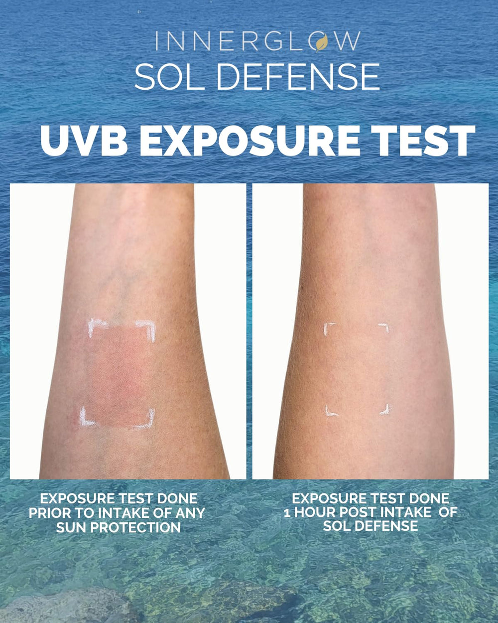 Inner Glow Sol Defense Gummies in pocket demonstrates on-the-go use.