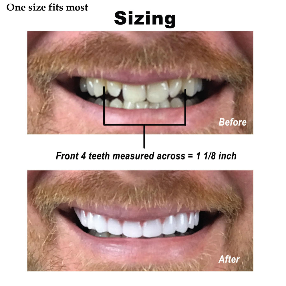Instant Smile Comfort Fit Flex product-in-use image demonstrates simple at-home fitting.