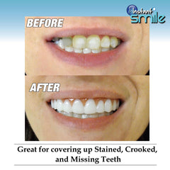 Instant Smile Comfort Fit Flex soft material close-up highlights comfortable, lightweight fit.