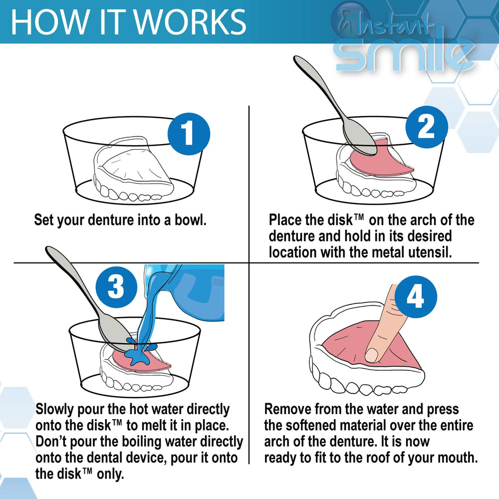 Instant Smile reliner material being reheated to refine denture shape.