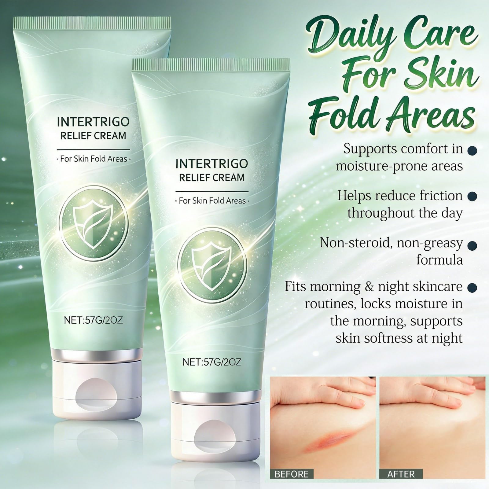 Intertrigo Cream in skin folds aids quick-drying comfort.