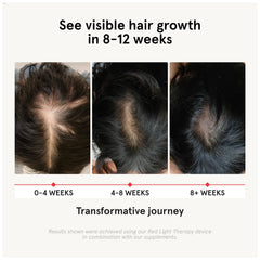 irestore capsules closeup showing vitamin-rich formula for hair and nails.