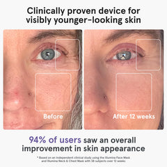 iRestore triple-wavelength technology panel enables targeted red, blue, and infrared treatments