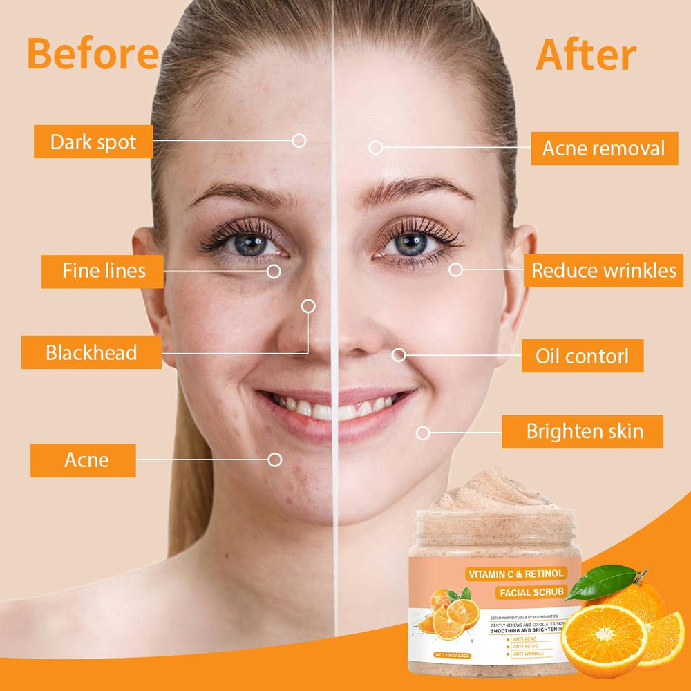 IREV Vitamin C Face Scrub bottle label close-up signaling brightening benefits