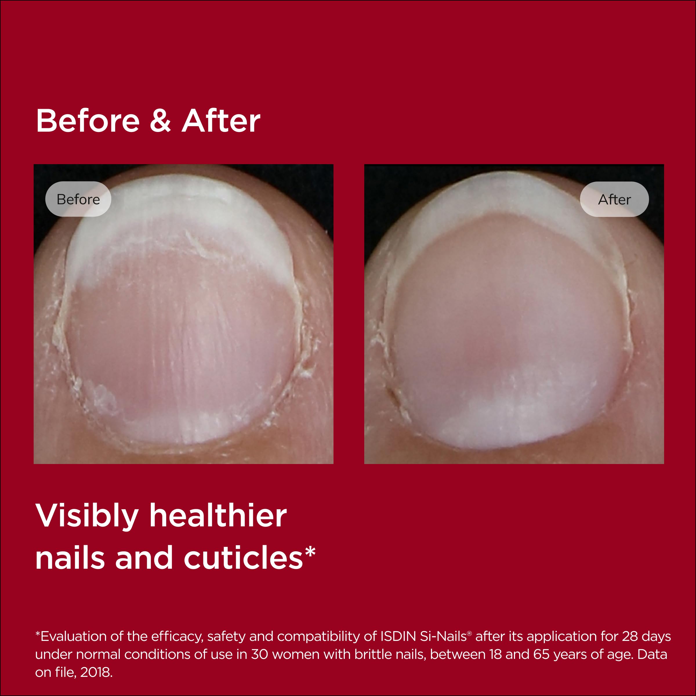 ISDIN Si-Nails hydration boost near the cuticle supports moisture retention.