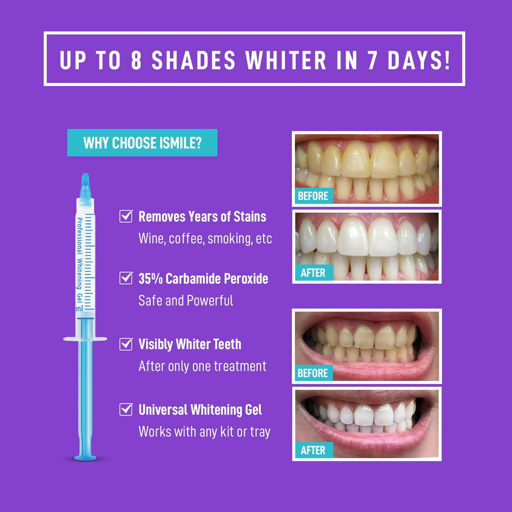 ismile remineralization gel syringe aids enamel protection after whitening at home
