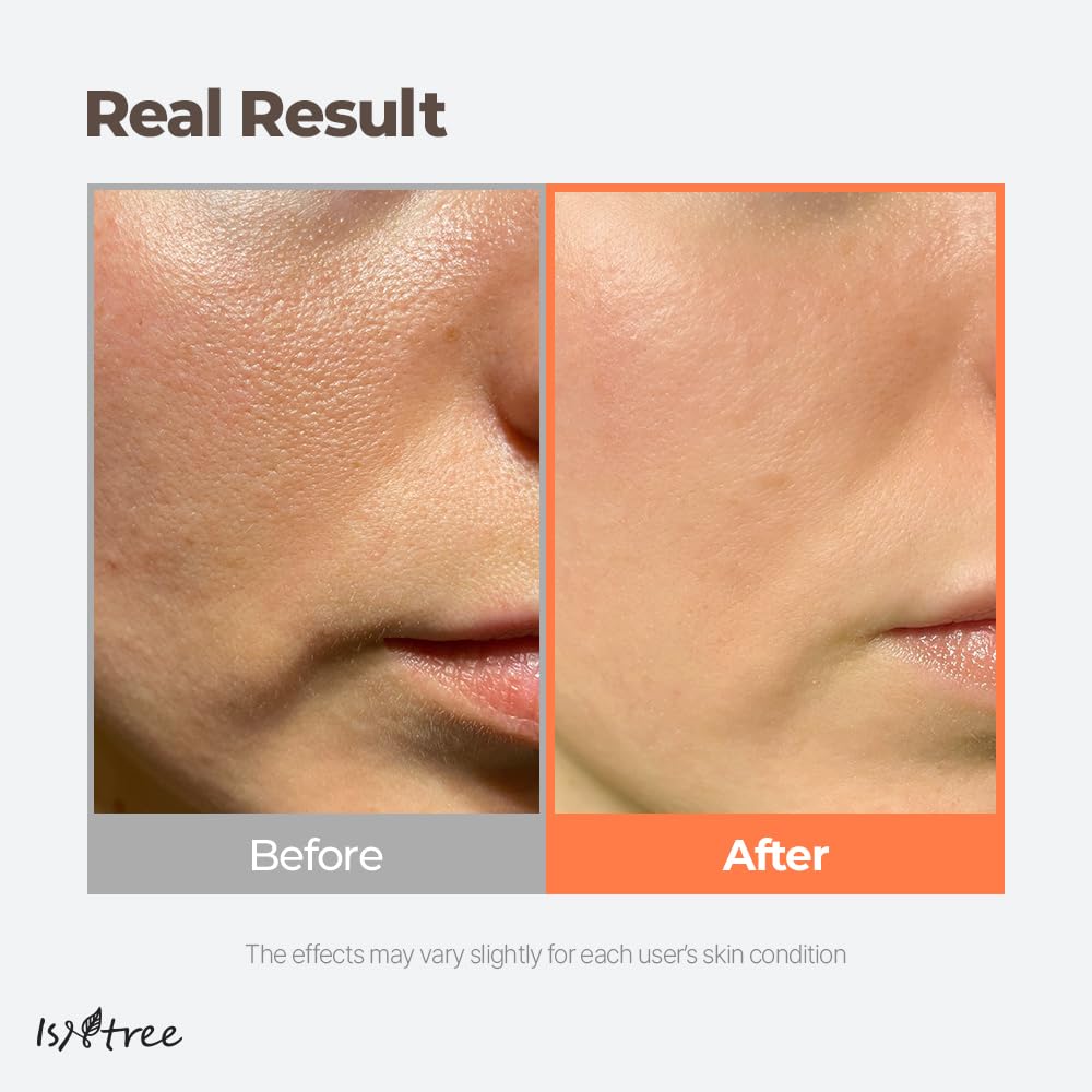 IsNtree ISNTTREE Green Tea Fresh Toner texture swirl shows refreshing, watery consistency for sensitive skin