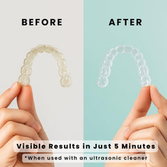 iSonic AlignerClean with dentures and retainers in use
