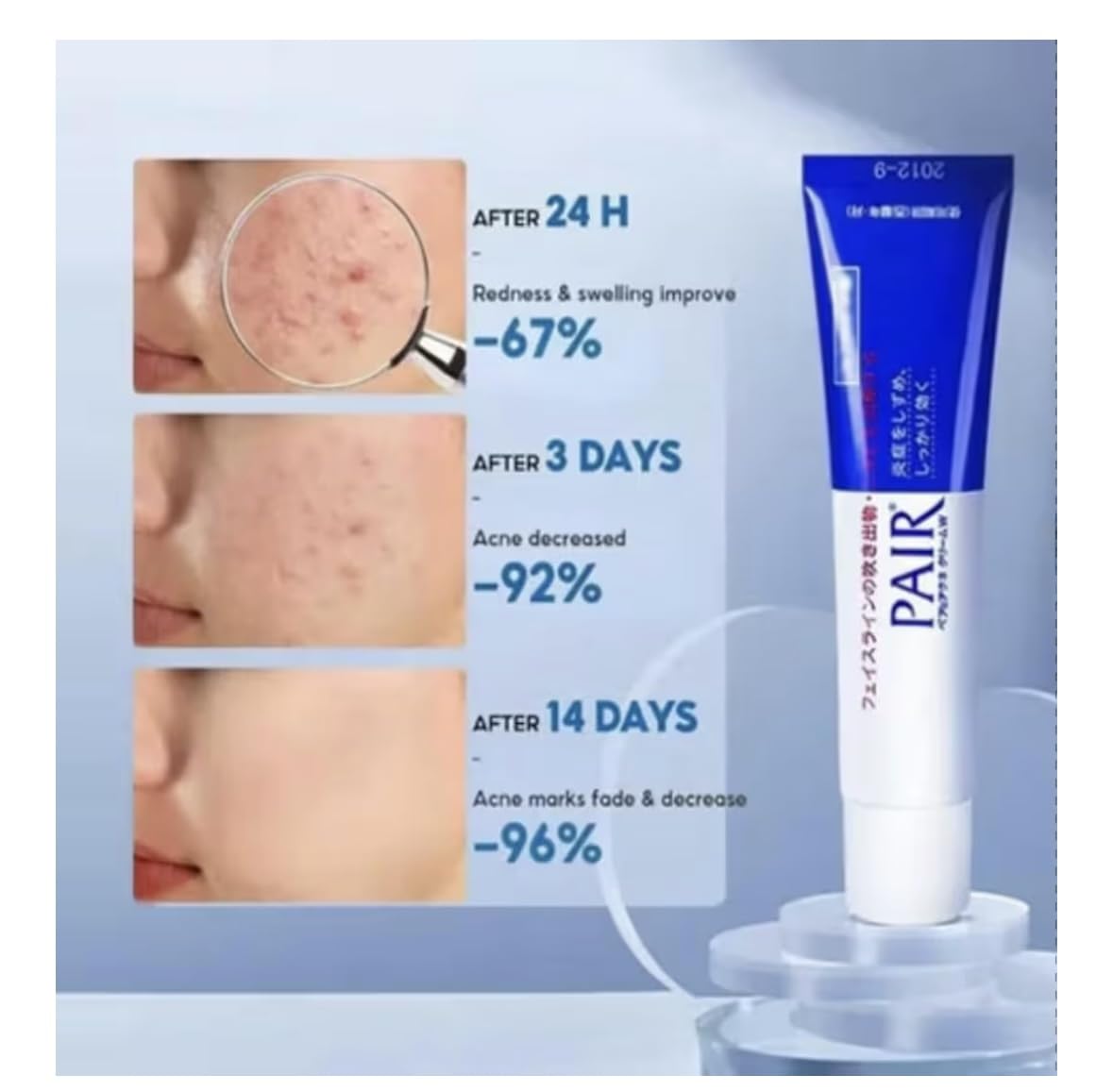 Japan Lion Pair Acne Cream product shot emphasizing blemish care benefits.