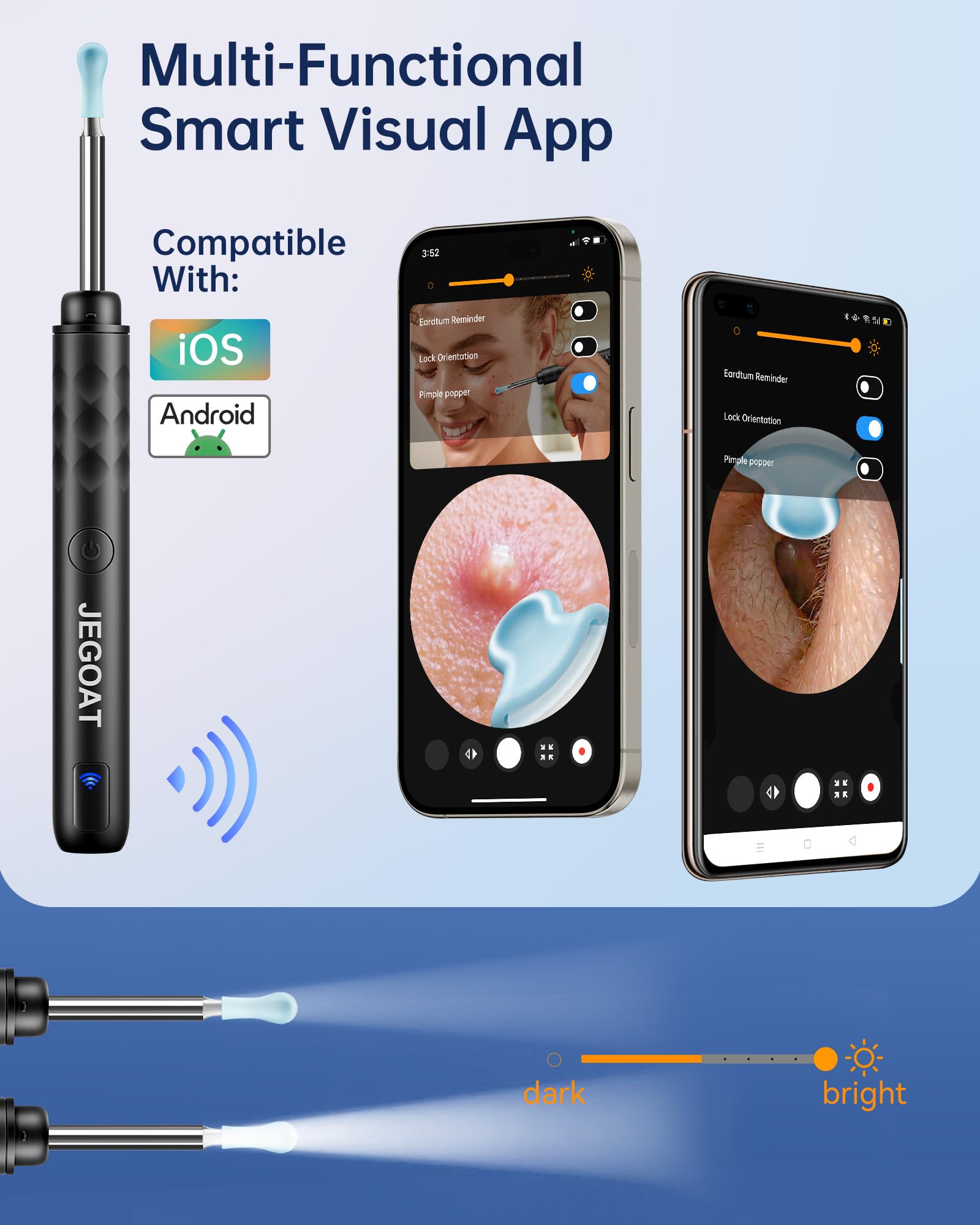 JEGOAT ear camera connects via WiFi to iOS/Android for real-time viewing