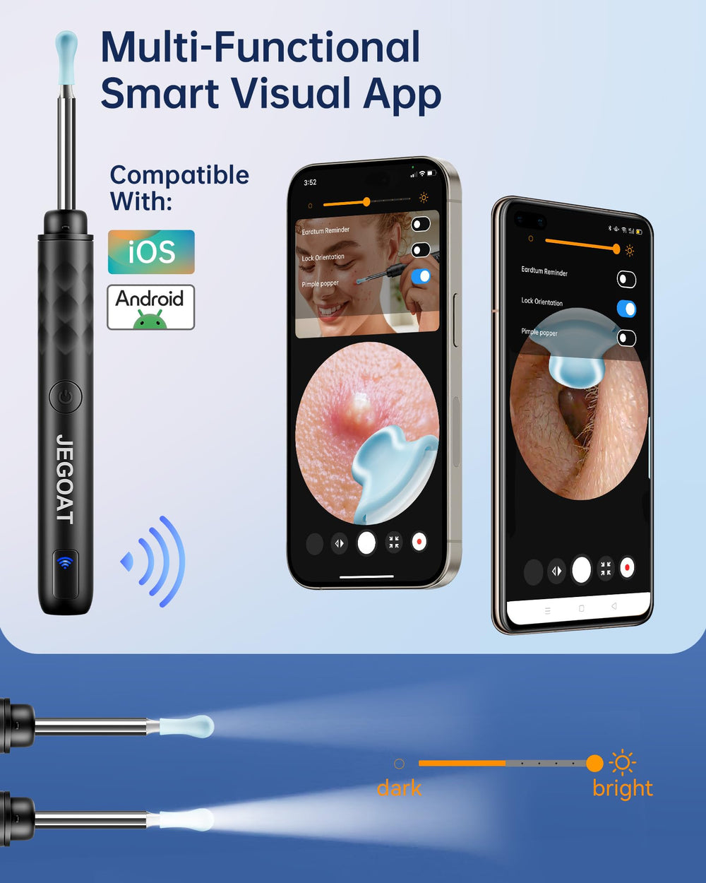 JEGOAT ear camera connects via WiFi to iOS/Android for real-time viewing