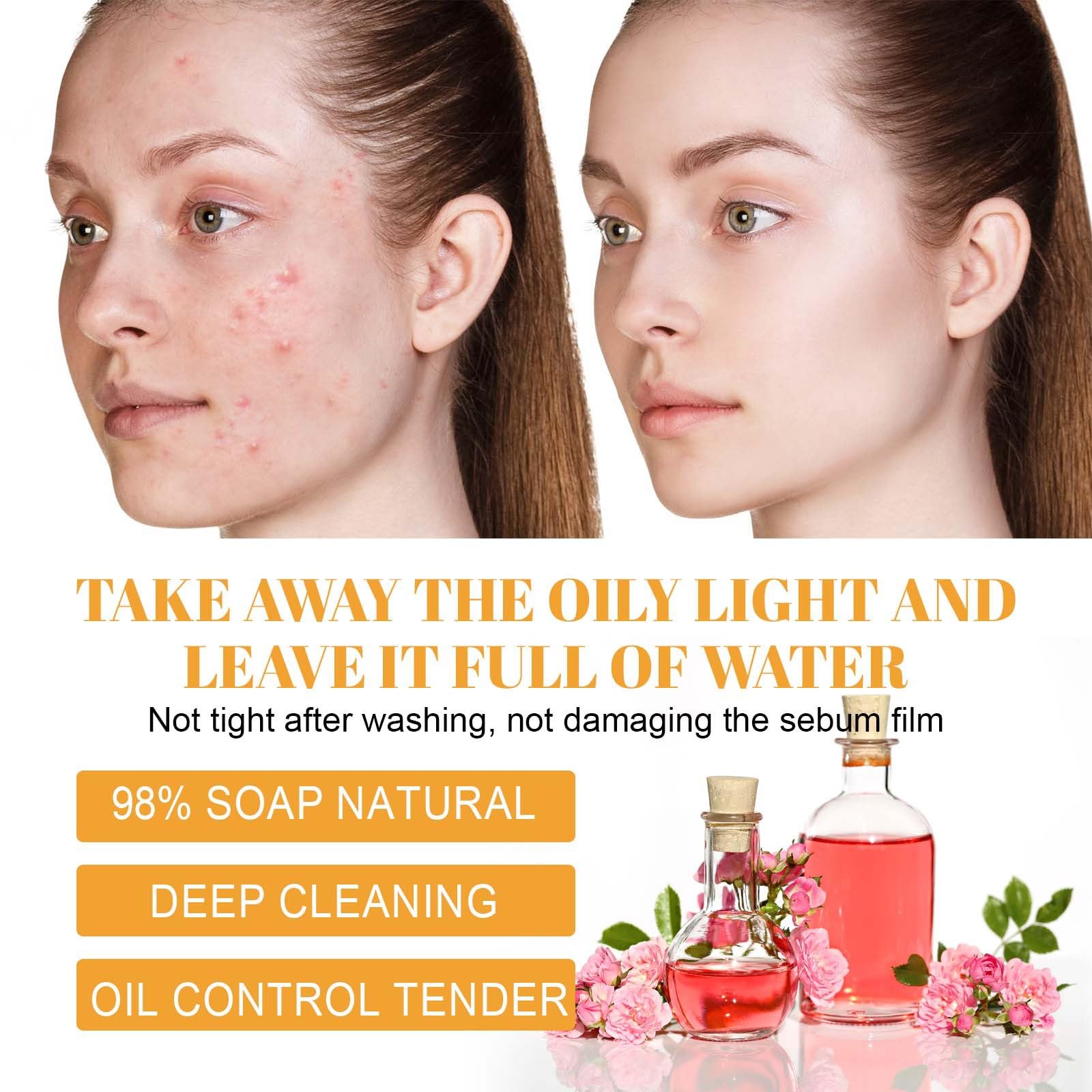JISKG All skin types friendly formula