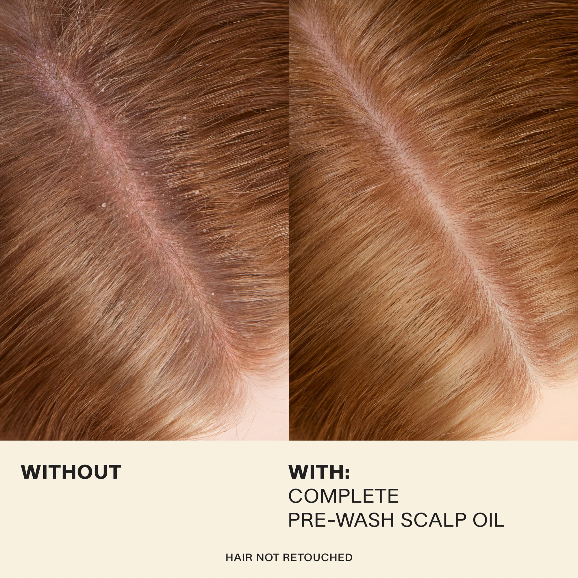 JVN Complete Pre-Wash Scalp Oil dropper close-up for precise application