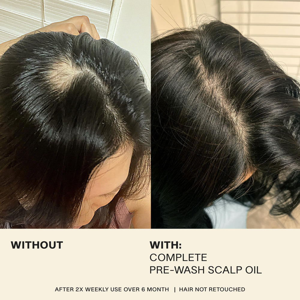 Hands massaging scalp with oil depicting a soothing ritual