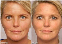 K6 Retinol Gel 0.1% application close-up on skin, illustrating gentle nightly use
