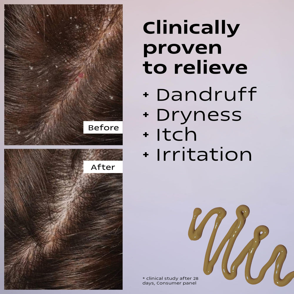KAMMEDIS scalp moisturizer texture reveals a light olive-brown consistency for easy spreading.
