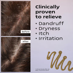 KAMMEDIS scalp moisturizer texture reveals a light olive-brown consistency for easy spreading.