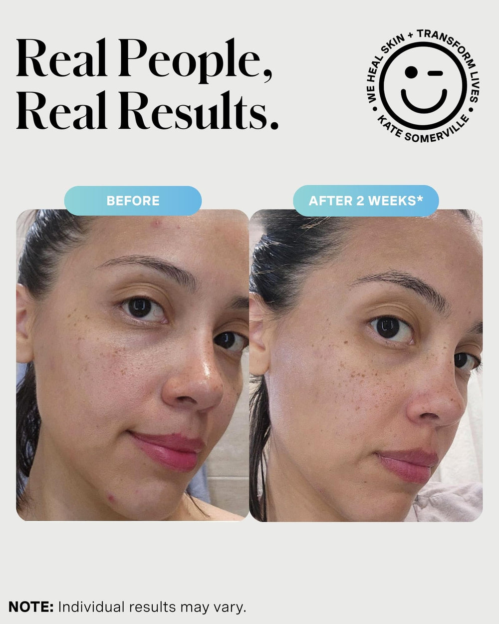 Sulfur mask use targets breakouts for deeper treatment.