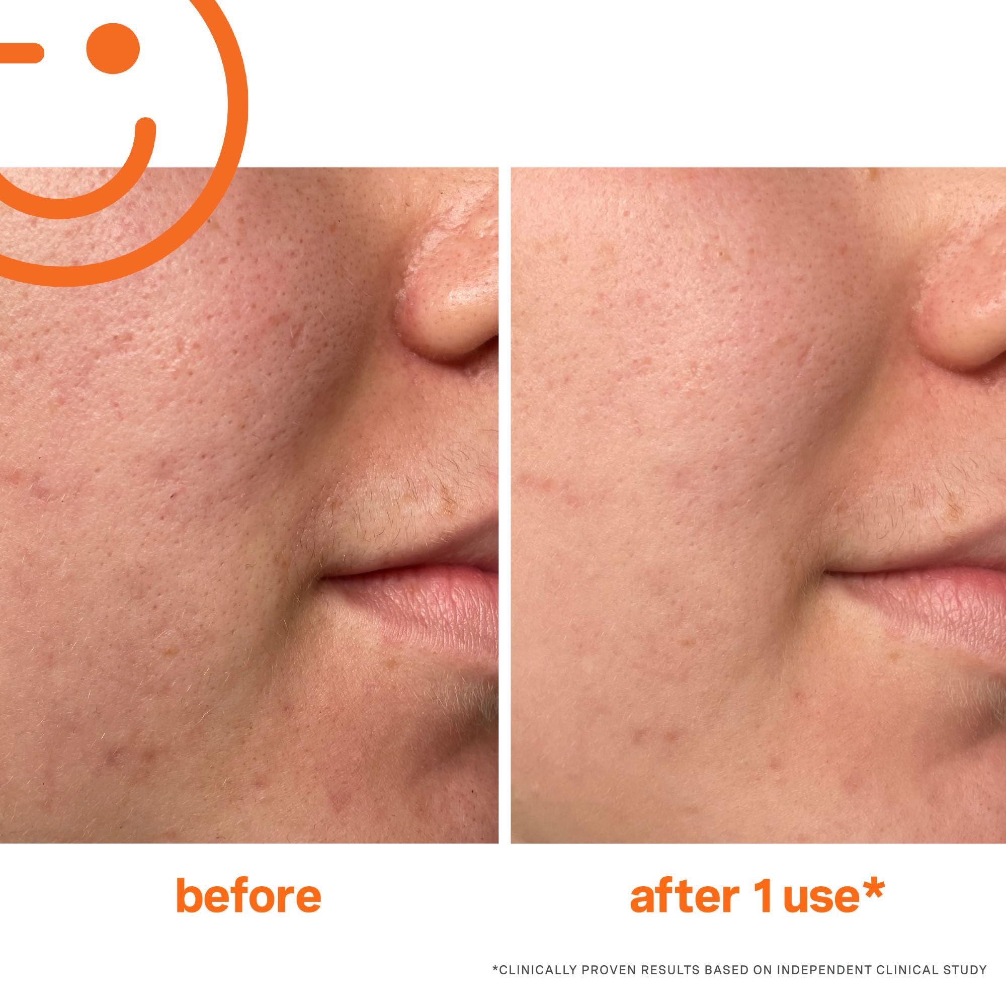 Kate Somerville Exfolikate ingredients featuring lactic and salicylic acids for refined pores