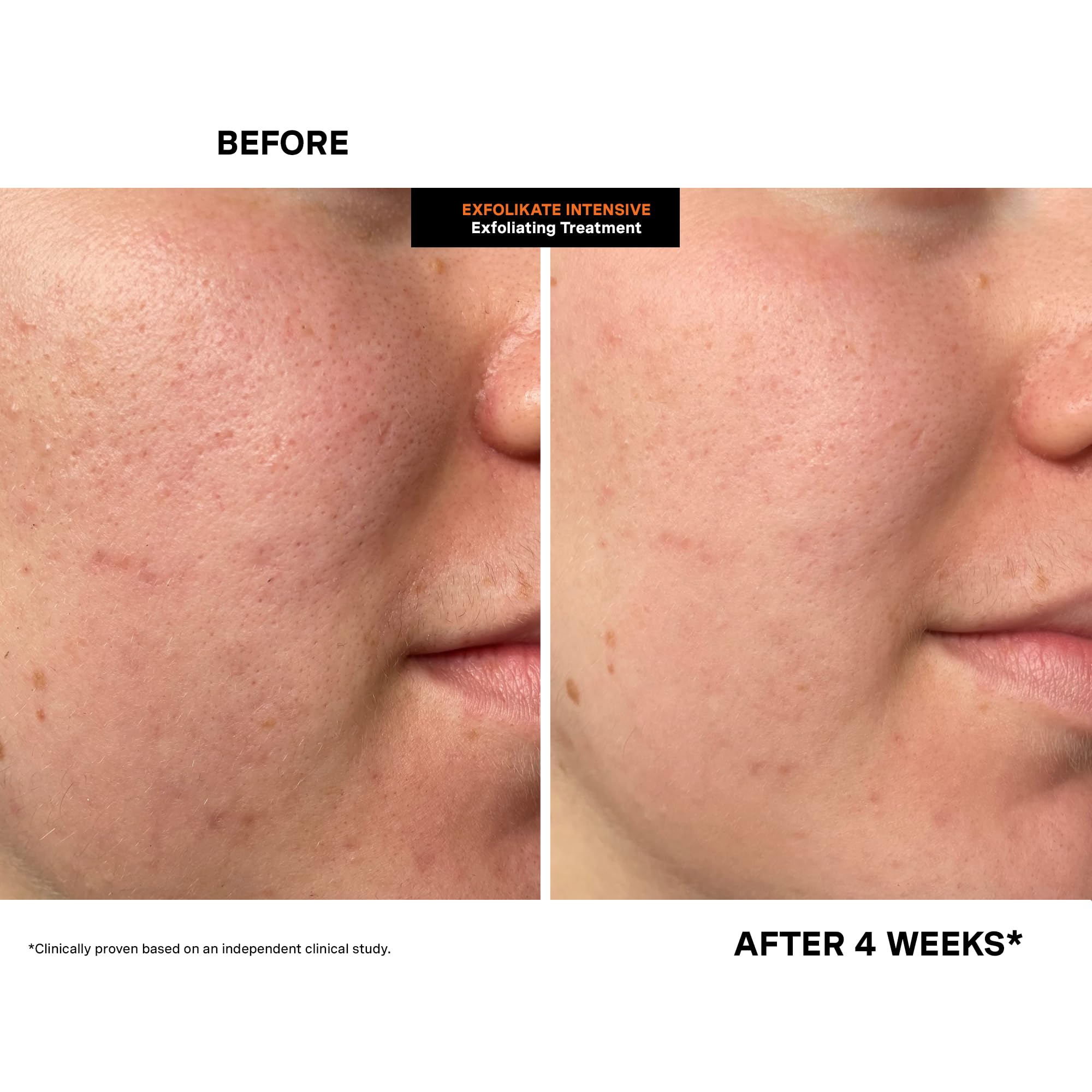 Kate Somerville Exfolikate Intensive product packaging in tube form