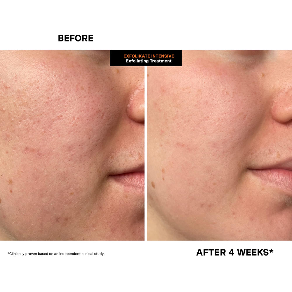 Kate Somerville Exfolikate Intensive product packaging in tube form