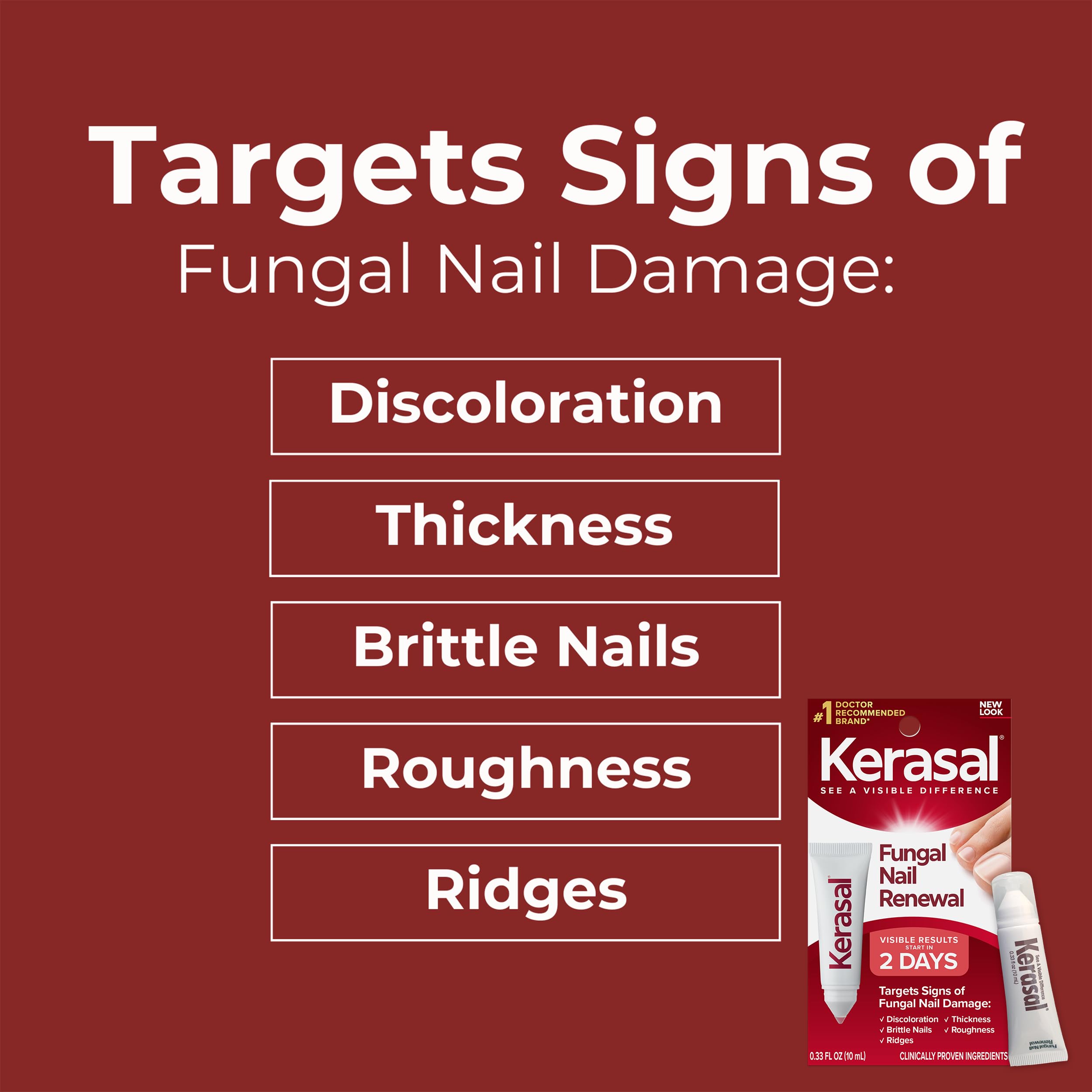 Kerasal Nail Renewal packaging on shelf indicating availability