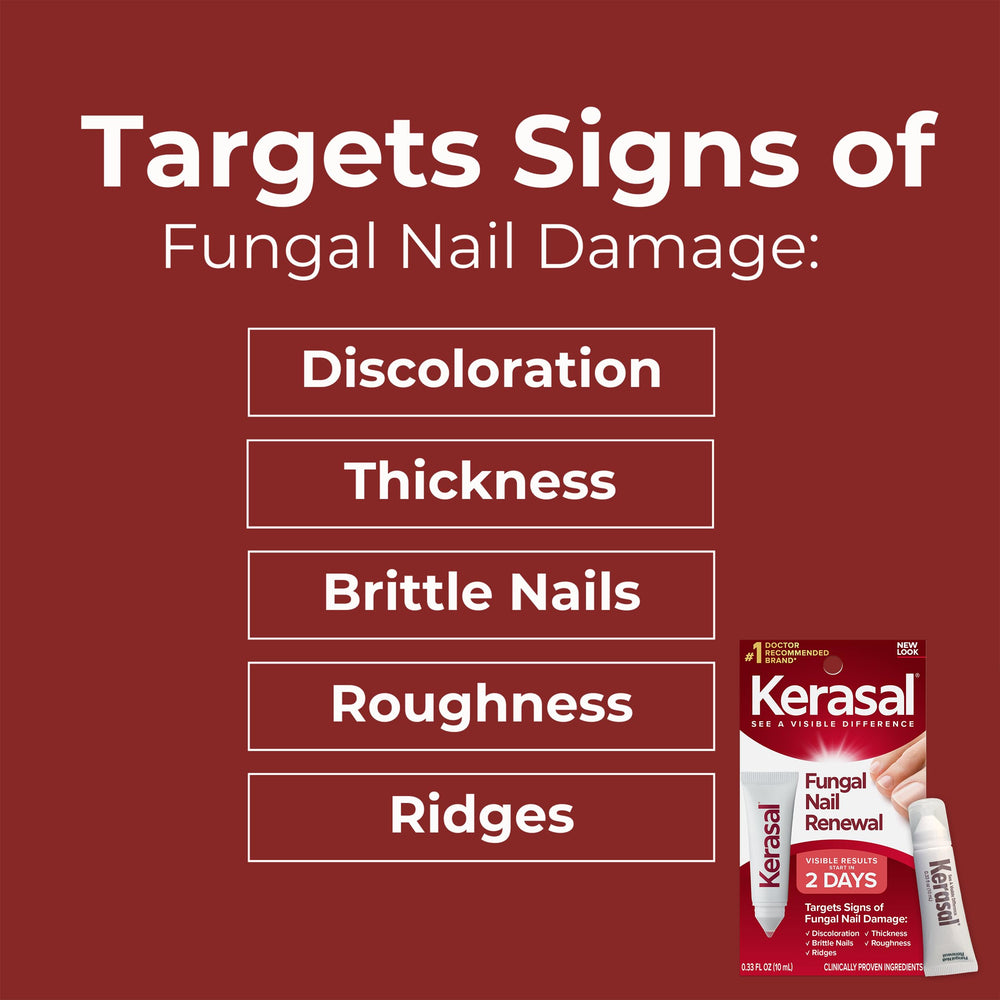 Kerasal Nail Renewal packaging on shelf indicating availability