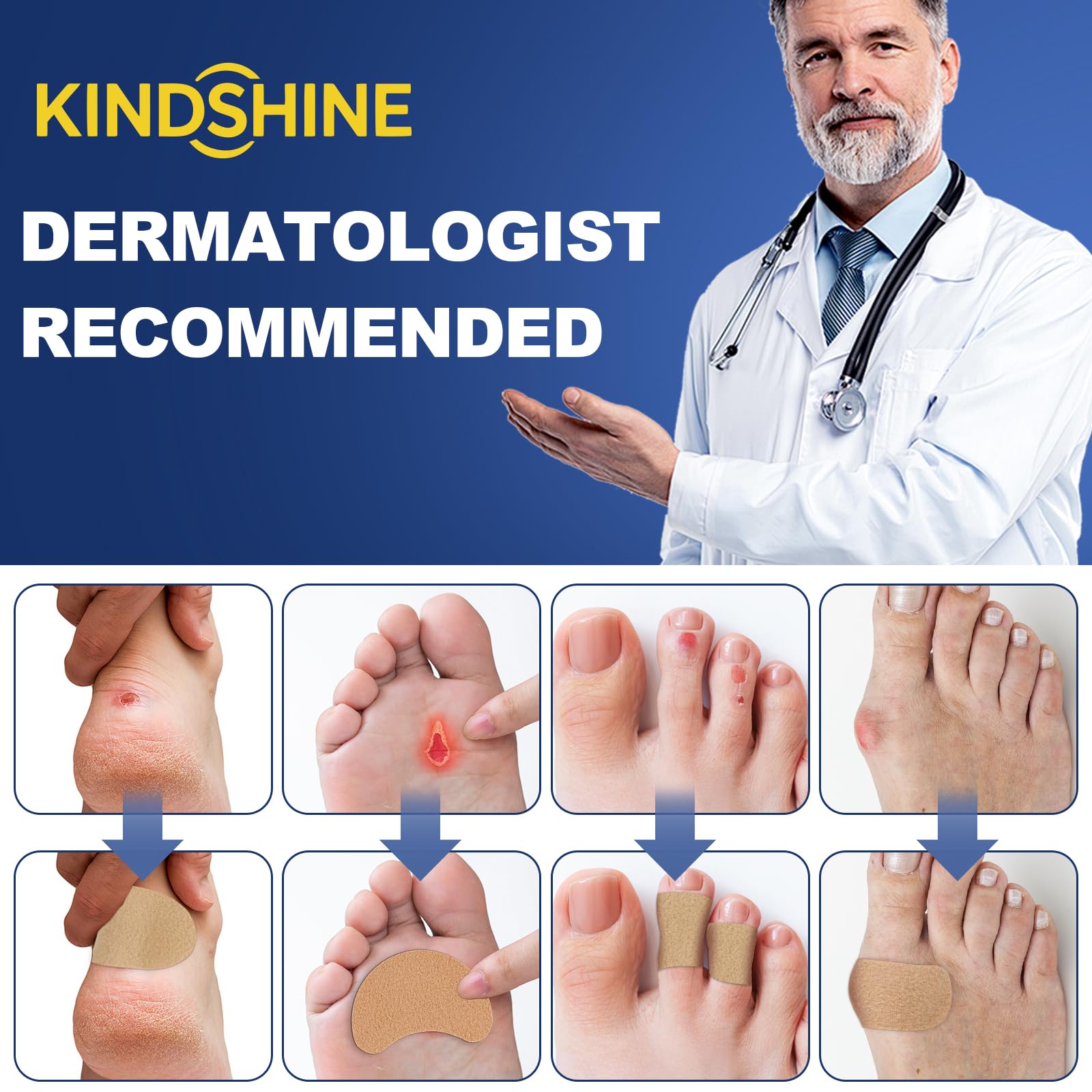 Kindshine forefoot and toe pads for travel and long walks