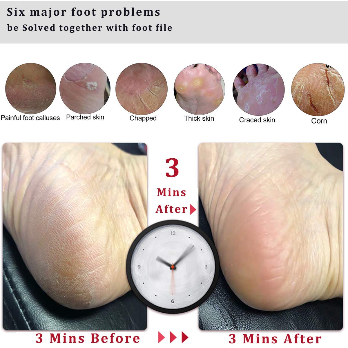 Double-sided Kinepi Foot File targets callus and rough skin for smoother feet.
