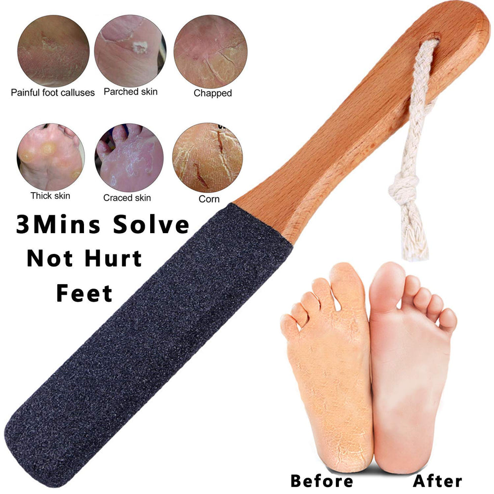 Kinepi Foot File shows natural corundum stone for effective exfoliation.