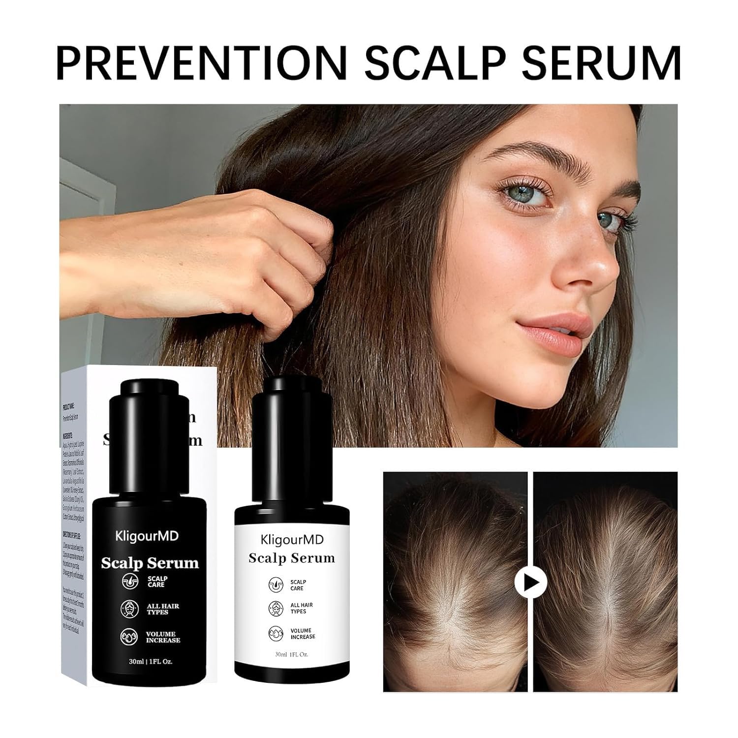 KligourMD dual-action serum application demonstrating prevention and treatment benefits