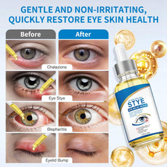 KODASNY Stye Eye Treatment package, lightweight and travel-friendly.