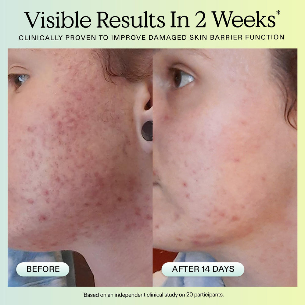 KraveBeauty Great Barrier Relief Serum being applied with a fast absorbing milky texture